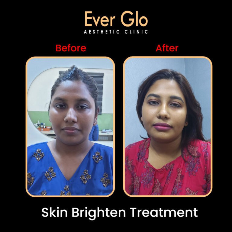 Skin Treatment