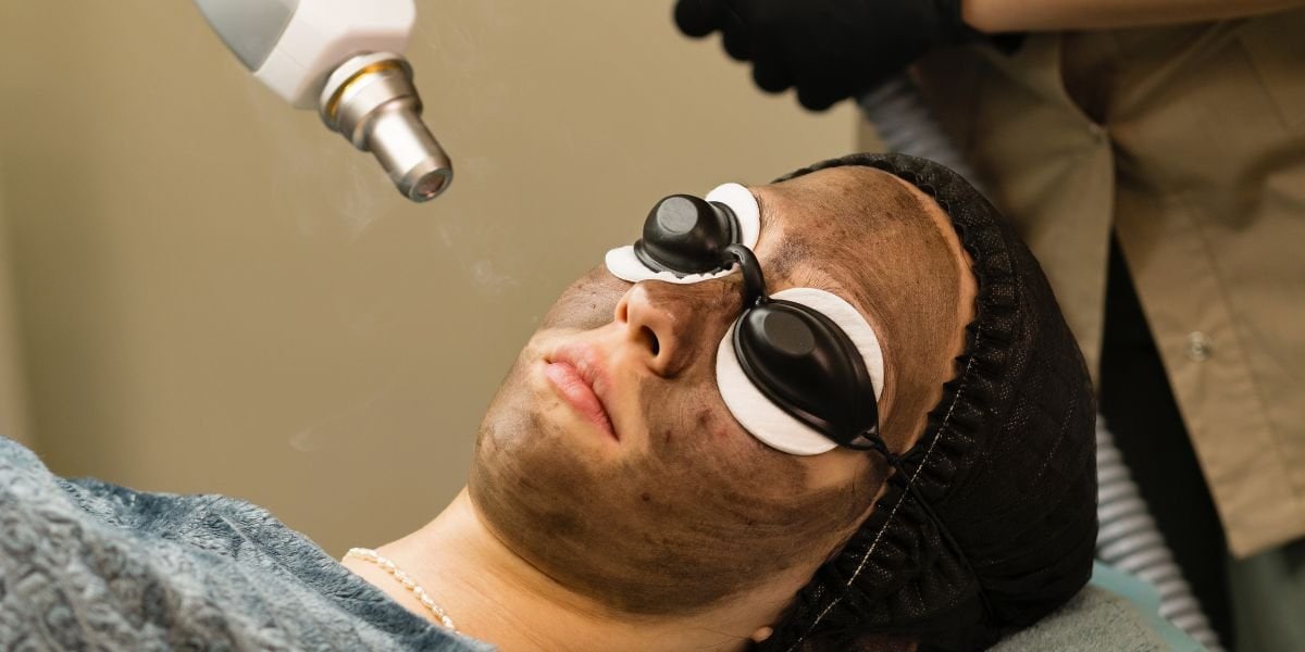 Carbon Facial