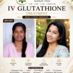 IV Glutathione Treatment in Velachery – Advanced Skin Brightening and Wellness Solution