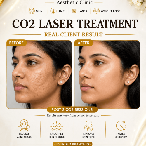 CO2 Laser Treatment coimbatore