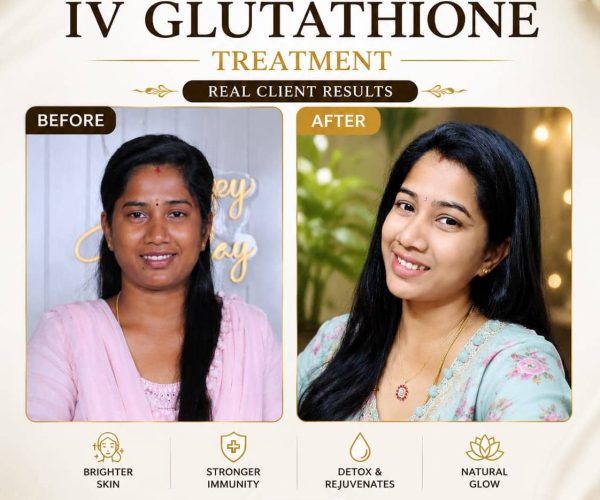 IV Glutathione Treatment in Velachery | EverGlo Aesthetic Clinic
